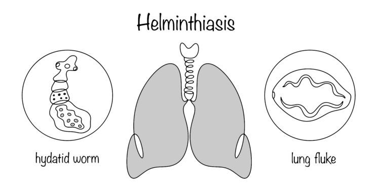 Paragonimozė: priežastys, simptomai, diagnostika ir gydymas
