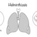 Paragonimozė: priežastys, simptomai, diagnostika ir gydymas
