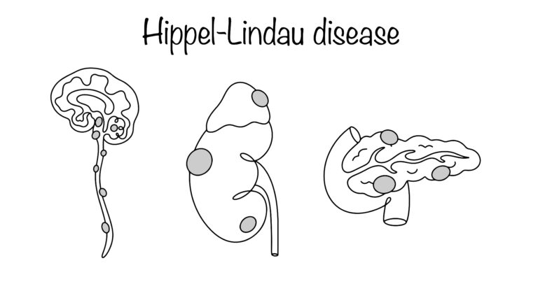 Hemangioblastoma: tipai, radiologija ir patologija