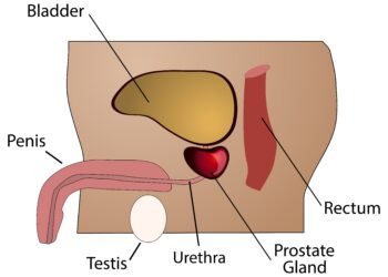 Varpos iškrypimas: ką tai reiškia ir kas laikoma įprasta