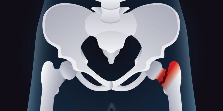 Sąnarių kraujavimas (hemartrozė): priežastys, simptomai ir gydymas