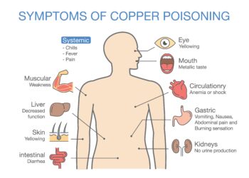Sunkiojo metalo apsinuodijimas: simptomai, priežastys ir gydymas