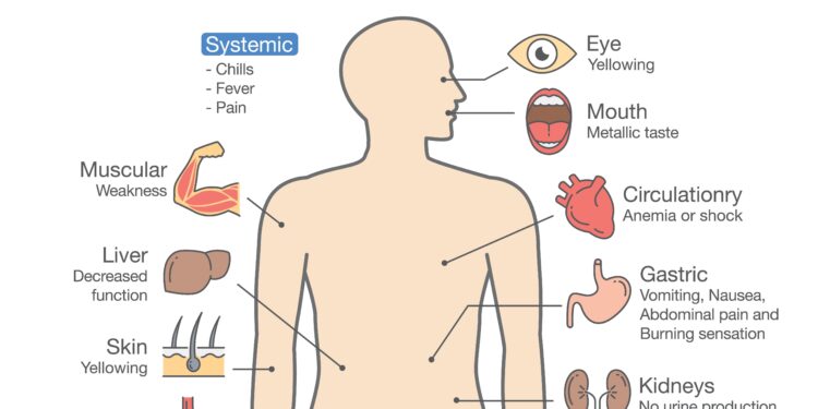 Sunkiojo metalo apsinuodijimas: simptomai, priežastys ir gydymas