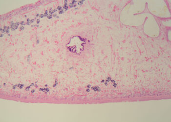 Kepenų siurbikė (fascioliazė): priežastys, simptomai ir gydymas