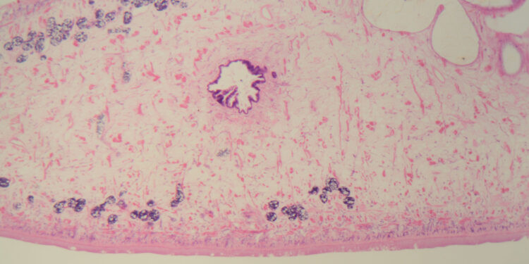 Kepenų siurbikė (fascioliazė): priežastys, simptomai ir gydymas