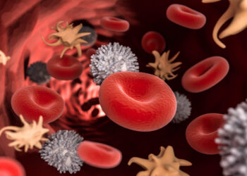 Hemofilija C (XI faktoriaus trūkumas): kas tai, simptomai ir gydymas