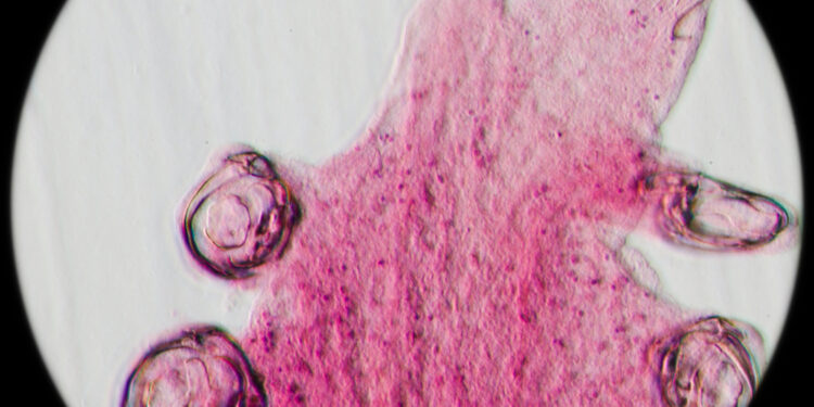 Kabligės infekcija: simptomai, gydymas ir užsikrėtimo būdai