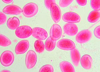 Mikrocitozė: priežastys, simptomai ir gydymas