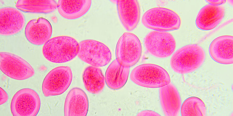 Mikrocitozė: priežastys, simptomai ir gydymas