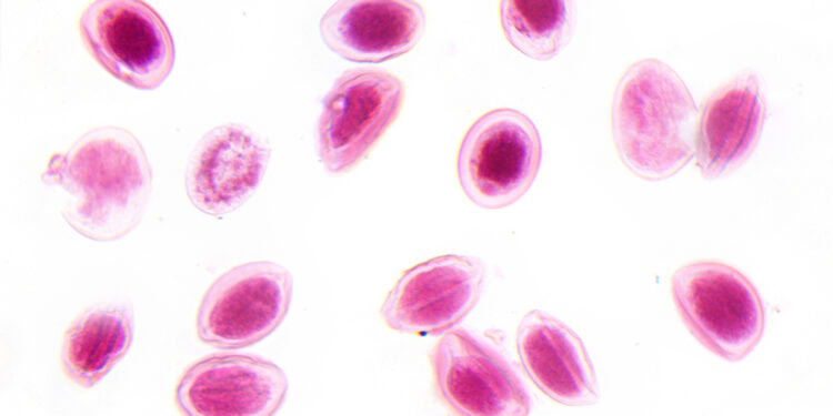 Pelgerio–Hueto anomalija: simptomai, priežastys ir gydymas