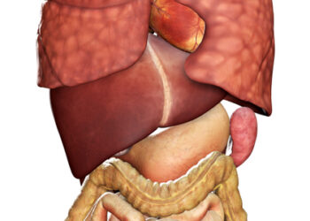 Klatskino navikai (hiluminė cholangiokarcinoma)