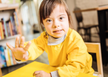 Kabuki sindromas: simptomai, priežastys ir gydymas