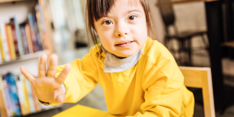 Kabuki sindromas: simptomai, priežastys ir gydymas