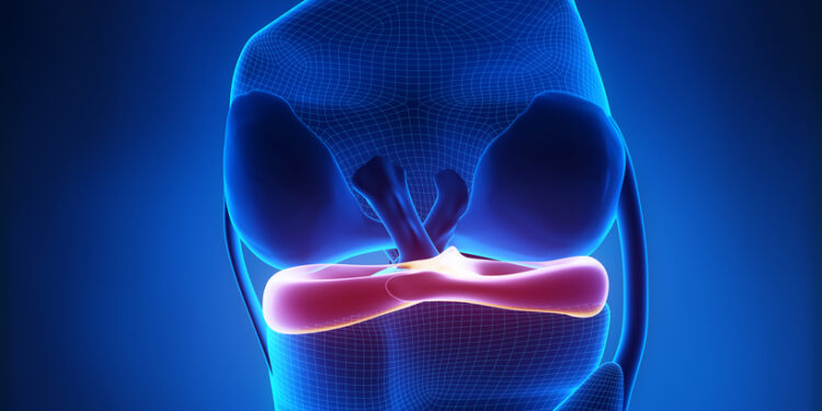 Šoninio šalutinio raiščio (LCL) plyšimas: priežastys, simptomai ir gydymas