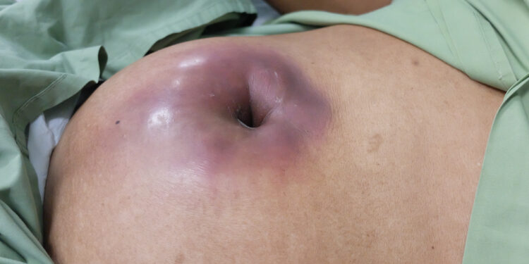 Priekinė gilioji smilkinio arterija