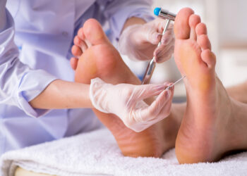 Piršto „plaktuko“ trauma: kas tai, galimos komplikacijos ir gijimo trukmė