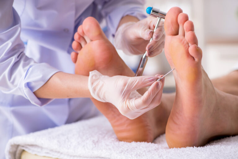Piršto „plaktuko“ trauma: kas tai, galimos komplikacijos ir gijimo trukmė