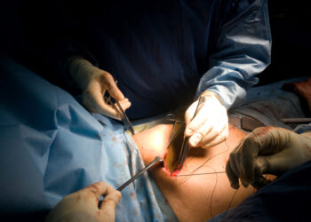 Esminė trombocitemija: apibrėžimas, simptomai ir gydymas