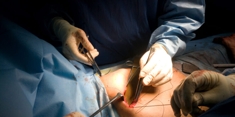 Esminė trombocitemija: apibrėžimas, simptomai ir gydymas