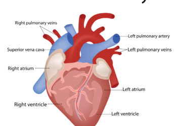 Aortos lanko hipoplazija