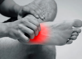 Kerionas: simptomai, priežastys ir gydymas