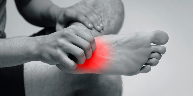 Kerionas: simptomai, priežastys ir gydymas