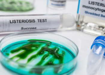 Listeriozė (listerijų sukeliama infekcija): priežastys, simptomai ir gydymas