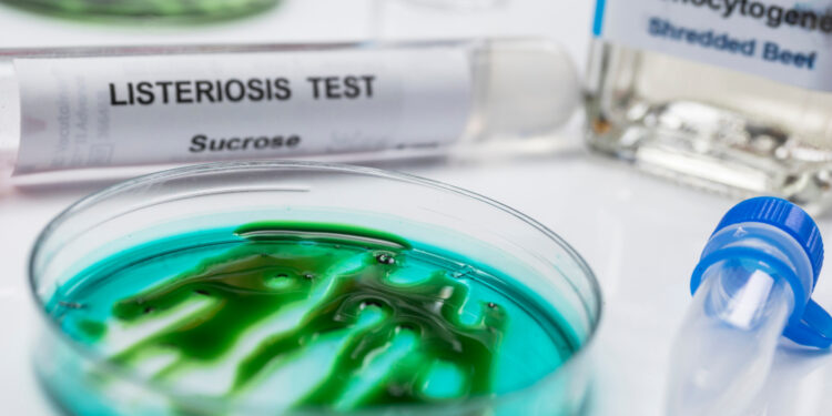 Listeriozė (listerijų sukeliama infekcija): priežastys, simptomai ir gydymas