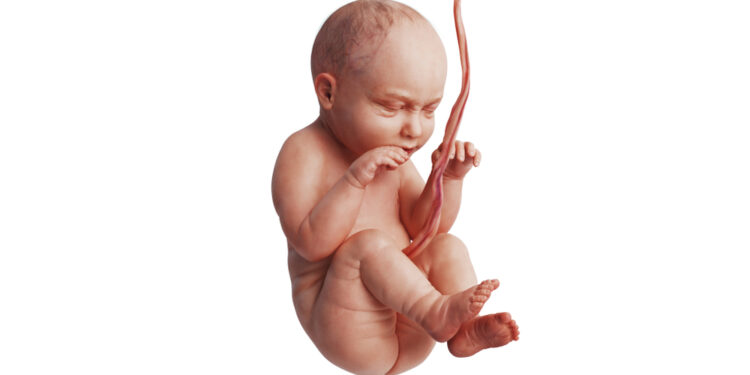 Omfalocelė: kas tai, priežastys, gydymas ir prognozė