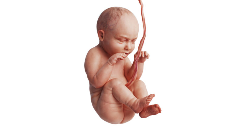 Omfalocelė: kas tai, priežastys, gydymas ir prognozė