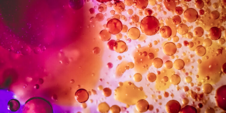 Mikrocitinė mažakraujystė: simptomai, priežastys ir gydymas