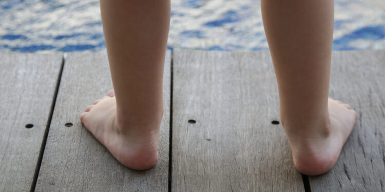 Perdėtas pėdos pronavimas: kas tai, priežastys ir gydymas