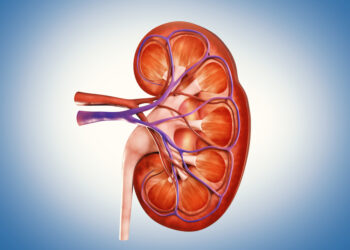 IgA nefropatija (Bergerio liga): simptomai ir gydymas