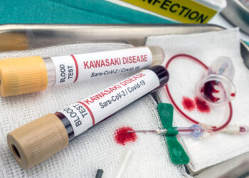 Kavasakio liga: simptomai, priežastys ir gydymas