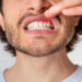 Dantenų uždegimas: simptomai ir gydymo būdai