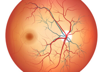 Regos nervo disko drūzos: priežastys, simptomai ir gydymas