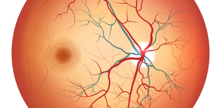 Regos nervo disko drūzos: priežastys, simptomai ir gydymas