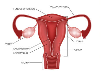 Mayerio–Rokitanskio–Kiusterio–Hauser sindromas: apžvalga