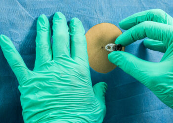 Paraneoplastiniai sindromai: simptomai, tipai ir gydymas