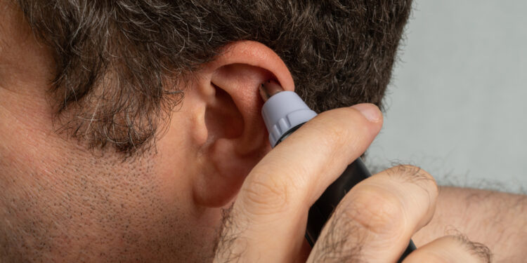 Ausų plaukuotumas: priežastys, reikšmė ir šalinimas