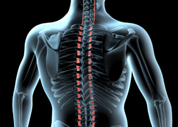 Hidromielija: kas tai, priežastys, simptomai ir prognozė