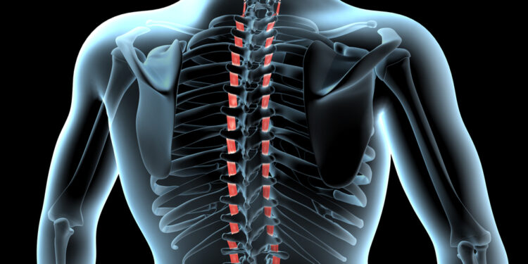 Hidromielija: kas tai, priežastys, simptomai ir prognozė