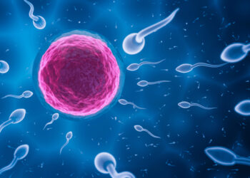 Oligospermija (sumažėjęs spermatozoidų kiekis): priežastys ir gydymas