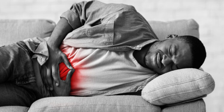 Opinės kolito (OK) eigos supratimas