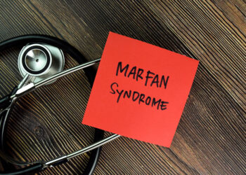 Sąnarių hipermobilumo sindromas: simptomai, priežastys, diagnostika ir gydymas