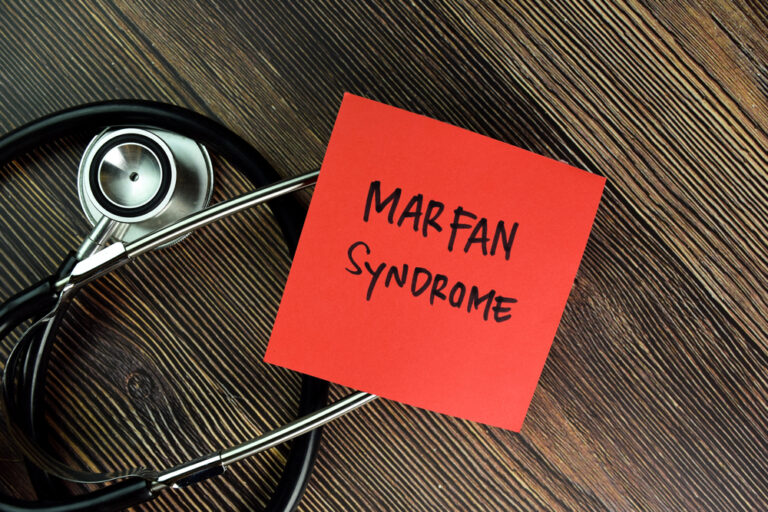 Sąnarių hipermobilumo sindromas: simptomai, priežastys, diagnostika ir gydymas