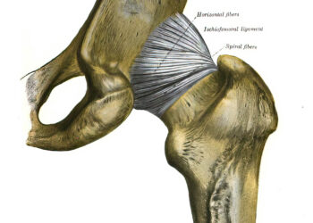 Kalnelio–Sachso pažeidimas: kas tai, simptomai ir gydymas