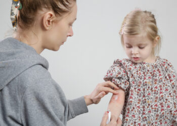 Jūsų dažniausiai užduodami klausimai: žvynelinė vaikams