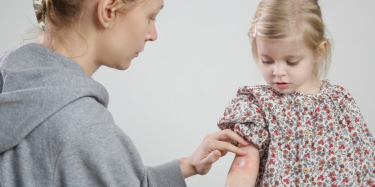 Jūsų dažniausiai užduodami klausimai: žvynelinė vaikams