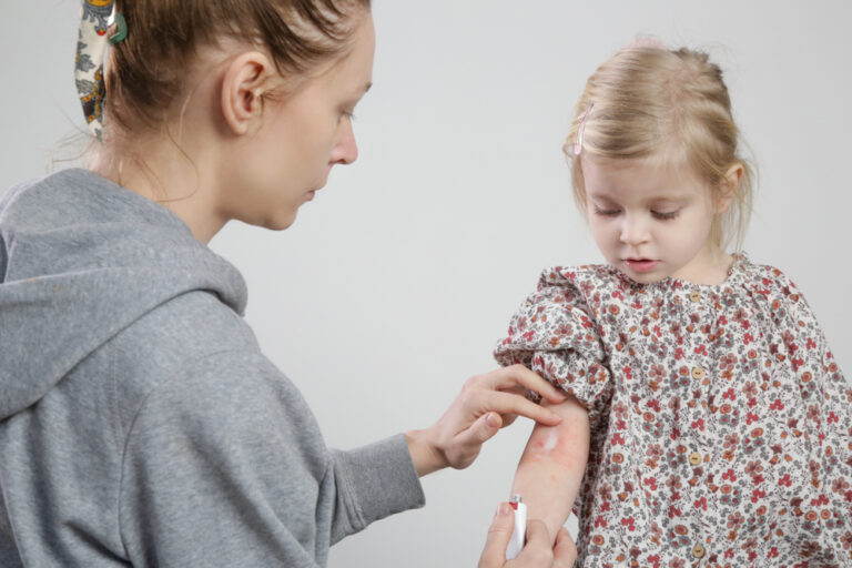 Jūsų dažniausiai užduodami klausimai: žvynelinė vaikams
